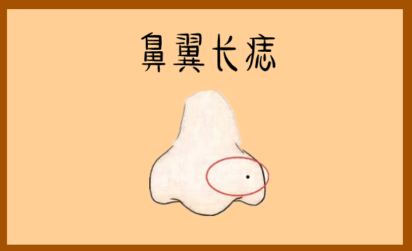 身体有这4颗辛苦痣，手里没积蓄，一辈子受穷！ 图片3