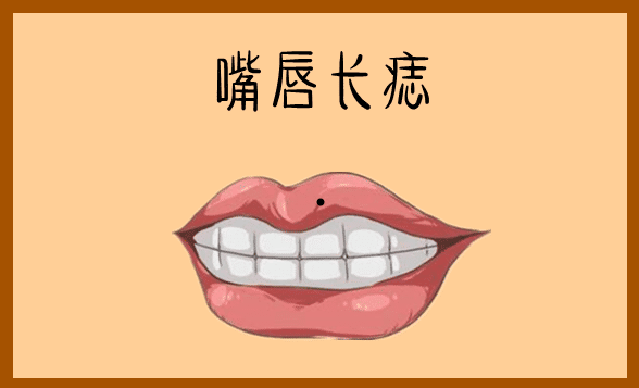 身体有这4颗辛苦痣，手里没积蓄，一辈子受穷！ 图片5