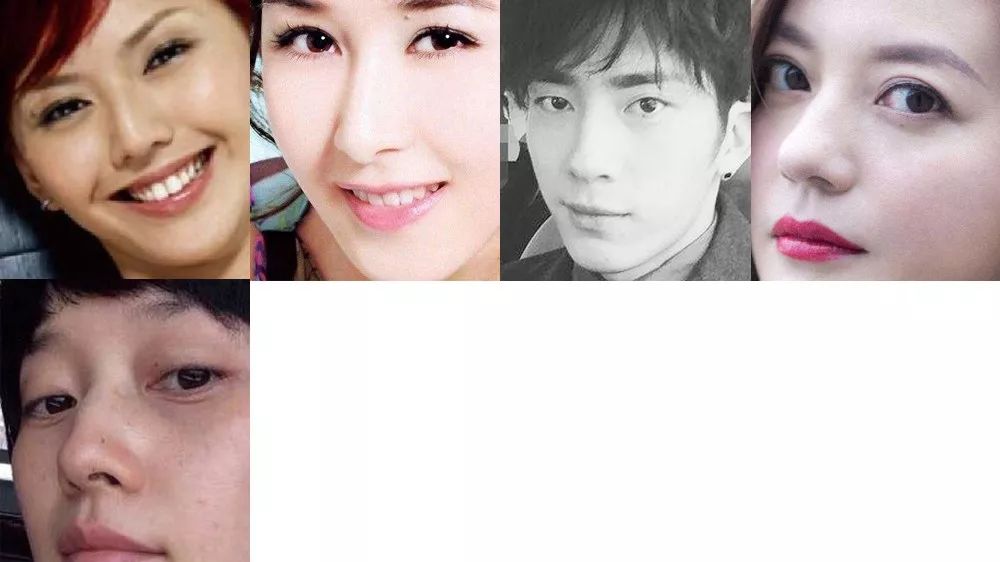 面相痣大全!分析长在这些地方的痣会带来哪些运势 图片10 面相痣大全!分析长在这些地方的痣会带来哪些运势 图片9