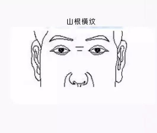 图解面相纹路：脸上的纹路打有玄机 图片5