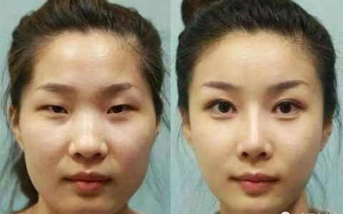 整容，可能你的命格经受不起，面相大师不建议整容