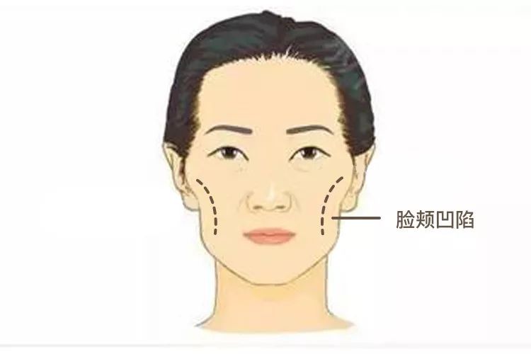 恶婆婆面相特征，这些面相特征的未来婆婆最难相处 图片1