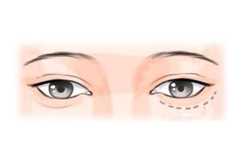 注定离婚的女人都有那些面相特征？ 图片5