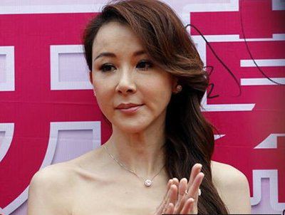 整容可以改变一个人的命运呢？ 图片1