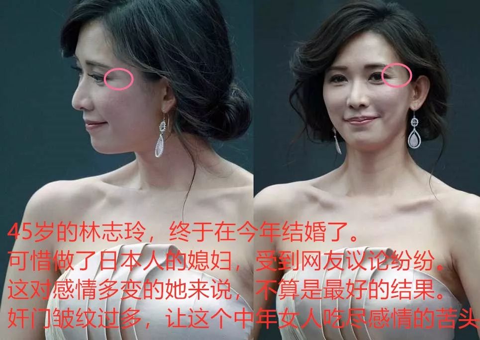 这种面相的人,别说夫妻,连朋友都没得做 图片24 这种面相的人,别说夫妻,连朋友都没得做 图片23