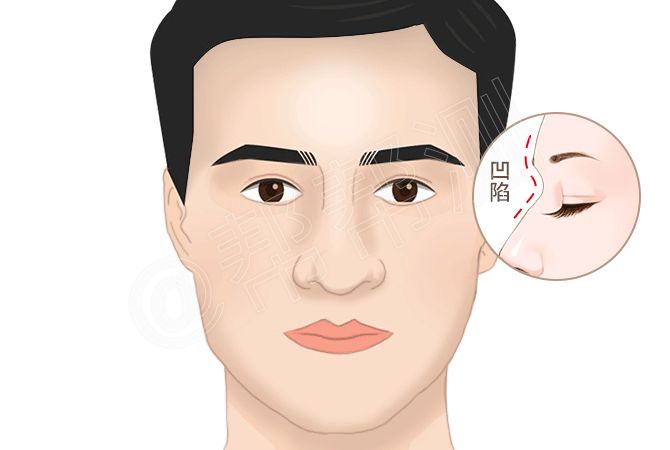 面相看你这辈子是靠另一半,靠子女还是靠自己? 图片4 面相看你这辈子是靠另一半,靠子女还是靠自己? 图片3