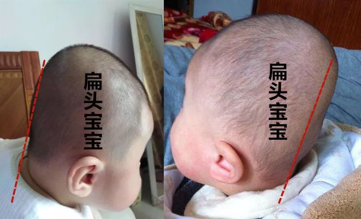 十头九扁，你的扁头真是福相代表吗？ 图片9