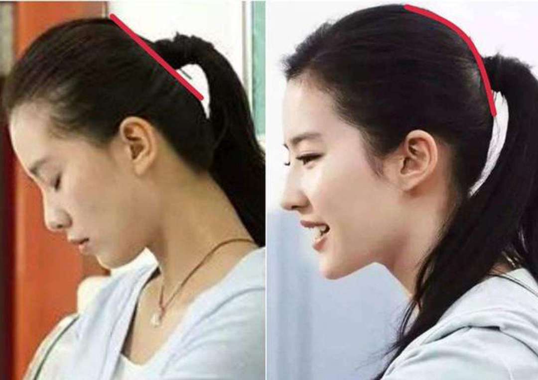 十头九扁，你的扁头真是福相代表吗？ 图片31