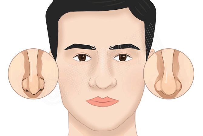 什么样的面相拥有最强财运？ 图片7