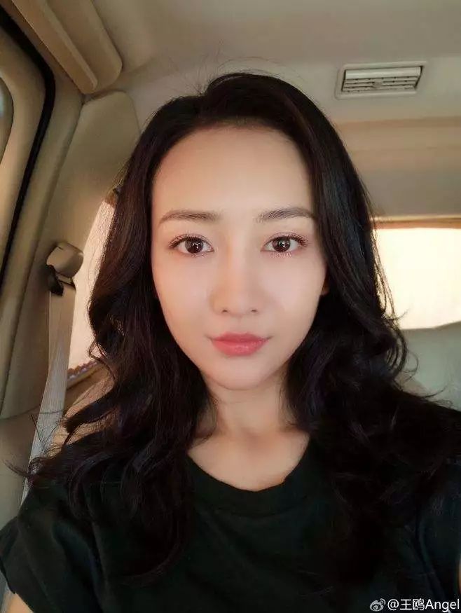 男靠鼻子，女靠嘴唇，你的唇部长的好吗？ 图片13