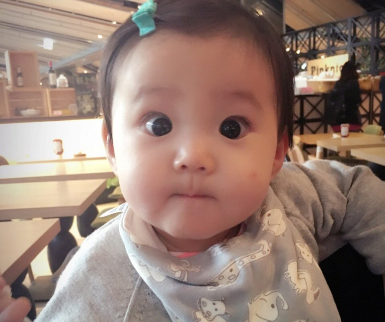 小孩身上三大吉痣，注定大富大贵 图片1
