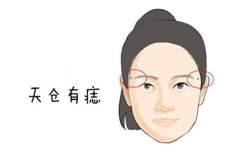 容易发家致富的痣相特征 图片1