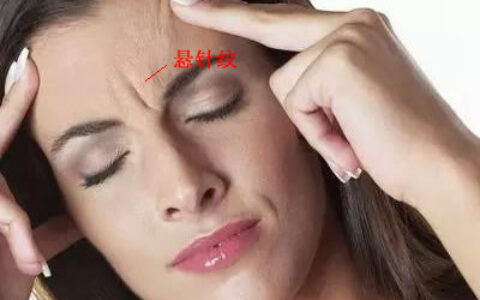 女人悬针纹代表什么悬针纹如何化解！