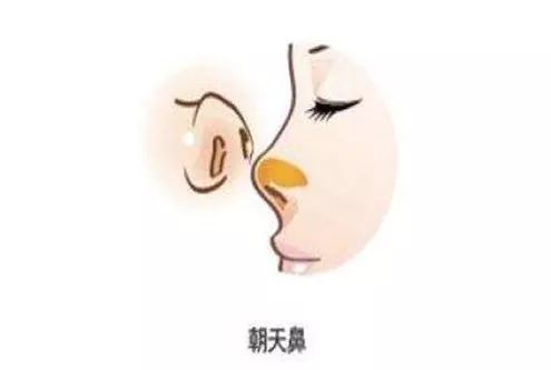 财库、财眉与十恶大败，有钱没钱看这些特征 图片29