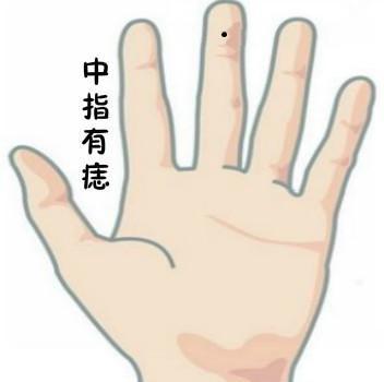五根手指的桃花痣各代表什么 图片1