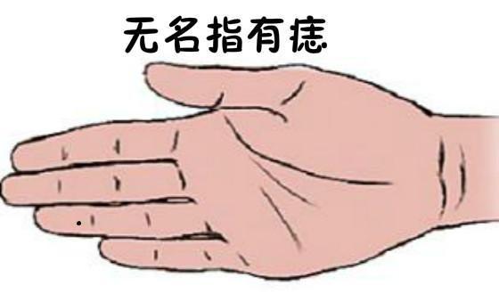 五根手指的桃花痣各代表什么 图片3