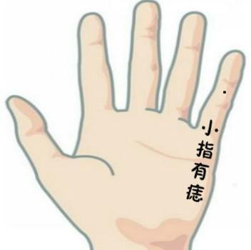 五根手指的桃花痣各代表什么 图片5