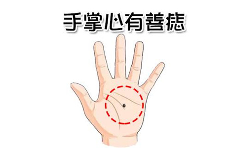 子女运佳的痣相特征 图片5