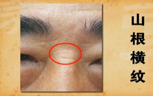 鼻梁上有横纹的女人不要娶 图片1