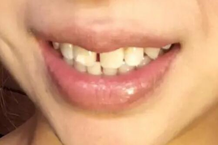 梦见牙齿松动是什么意思 此梦财运良好之意吗 图片16 梦见牙齿松动是什么意思 此梦财运良好之意吗 图片15