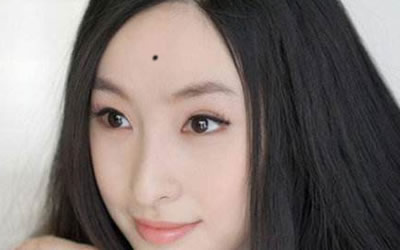 额头上的美人痣好不好？ 图片1