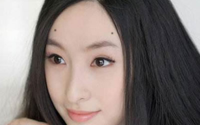 额头上的美人痣好不好？ 图片5