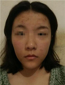 婚姻最难长久的三大面相揭秘 图片2 婚姻最难长久的三大面相揭秘 图片1