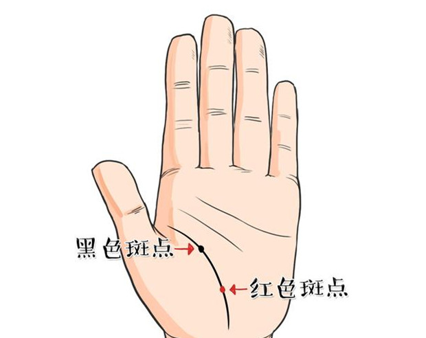 这三种手相的人，要注意身体健康了 图片5