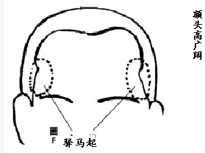 面相之额头看你一生命运如何 图片7
