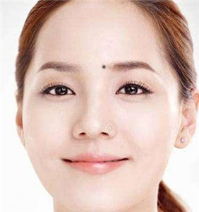 注定一生无忧的痣，你有几颗？ 图片3