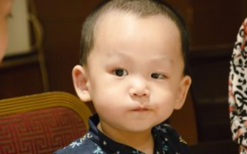 大小眼面相有哪些特点