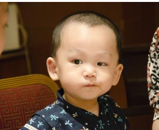 大小眼面相有哪些特点 图片1