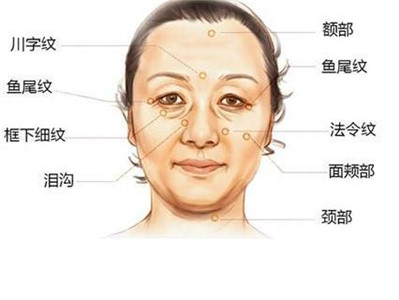 从法令纹看你的命运 图片3
