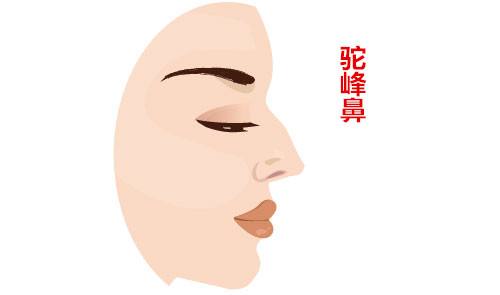 脾气火爆的四种面相 图片4 脾气火爆的四种面相 图片3