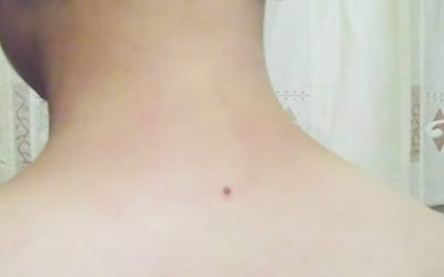 男人有苦情痣吗苦情痣代表什么？ 图片1