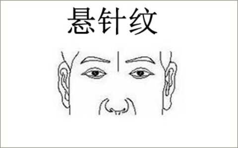 悬针纹好不好如何去掉悬针纹？