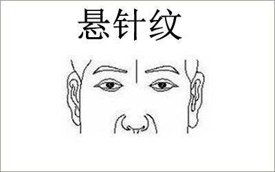 悬针纹好不好如何去掉悬针纹？ 图片1