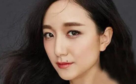 痣长在这些地方的女人，谁娶回家谁发！ 图片7