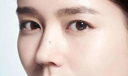 痣长在这些地方的女人，谁娶回家谁发！ 图片9
