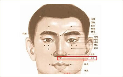 人中有痣代表什么可以点掉吗 图片2 人中有痣代表什么可以点掉吗 图片1