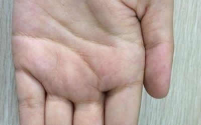 手相财运线附近有田字纹代表什么 图片1