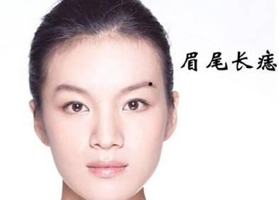 财运挡不住的痣相特征 图片1