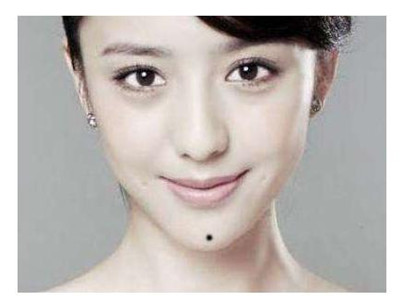 财运挡不住的痣相特征 图片3